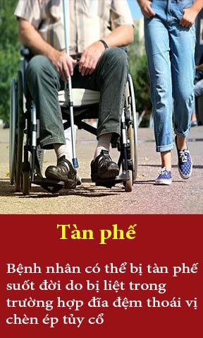 xương khớp
